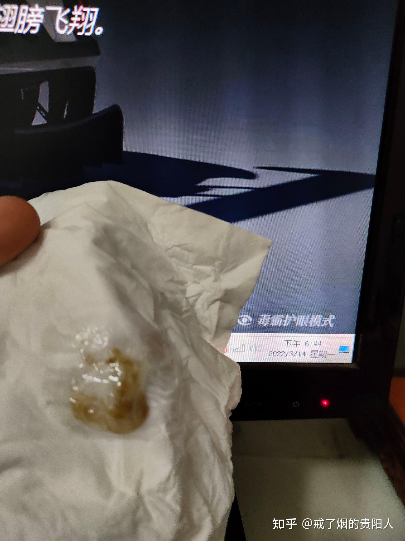 戒烟后吐出来的黑痰是什么物质