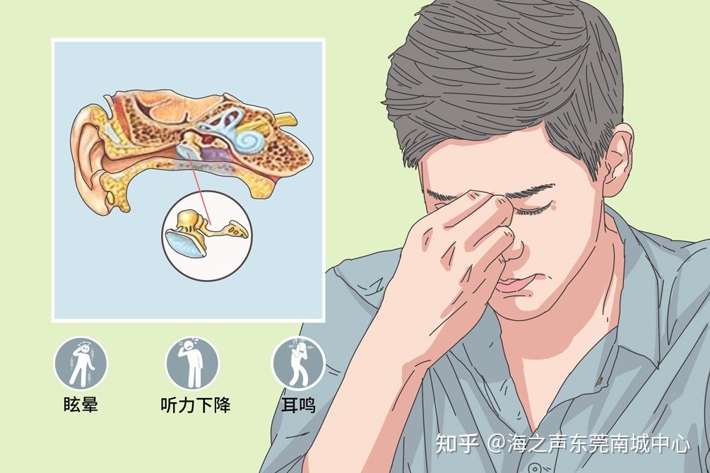 咽鼓管功能障碍和梅尼埃病有哪些区别? - 知乎