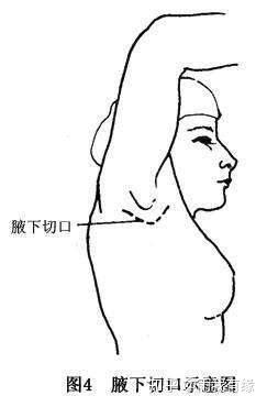 v2-229b76dd32fb1477e35ea6ff56afd424_b.jpg