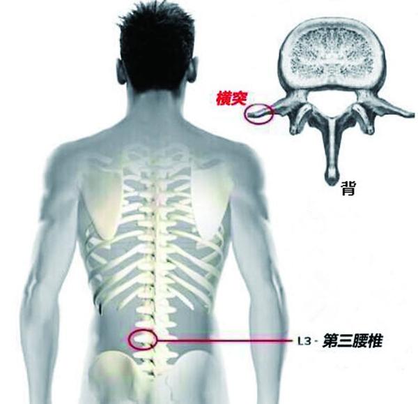 真假李逵 腰椎间盘突出症中的李鬼你遇见几个 知乎