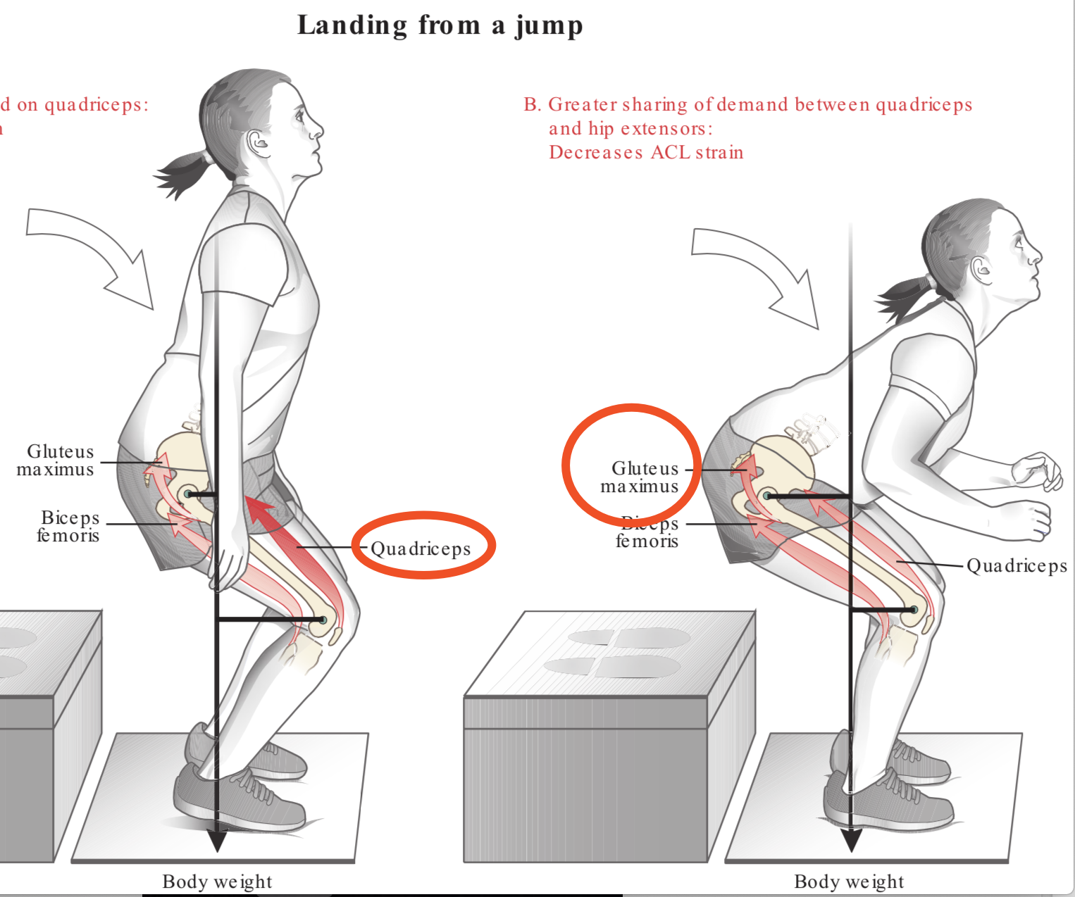 膝关节康复常见误区014——膝关节股内斜肌激活与训练（持续更新中） - 知乎