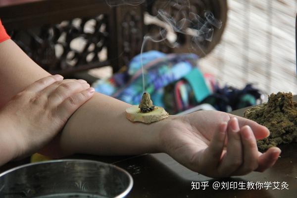 传统艾灸四大灸法简述 - 知乎