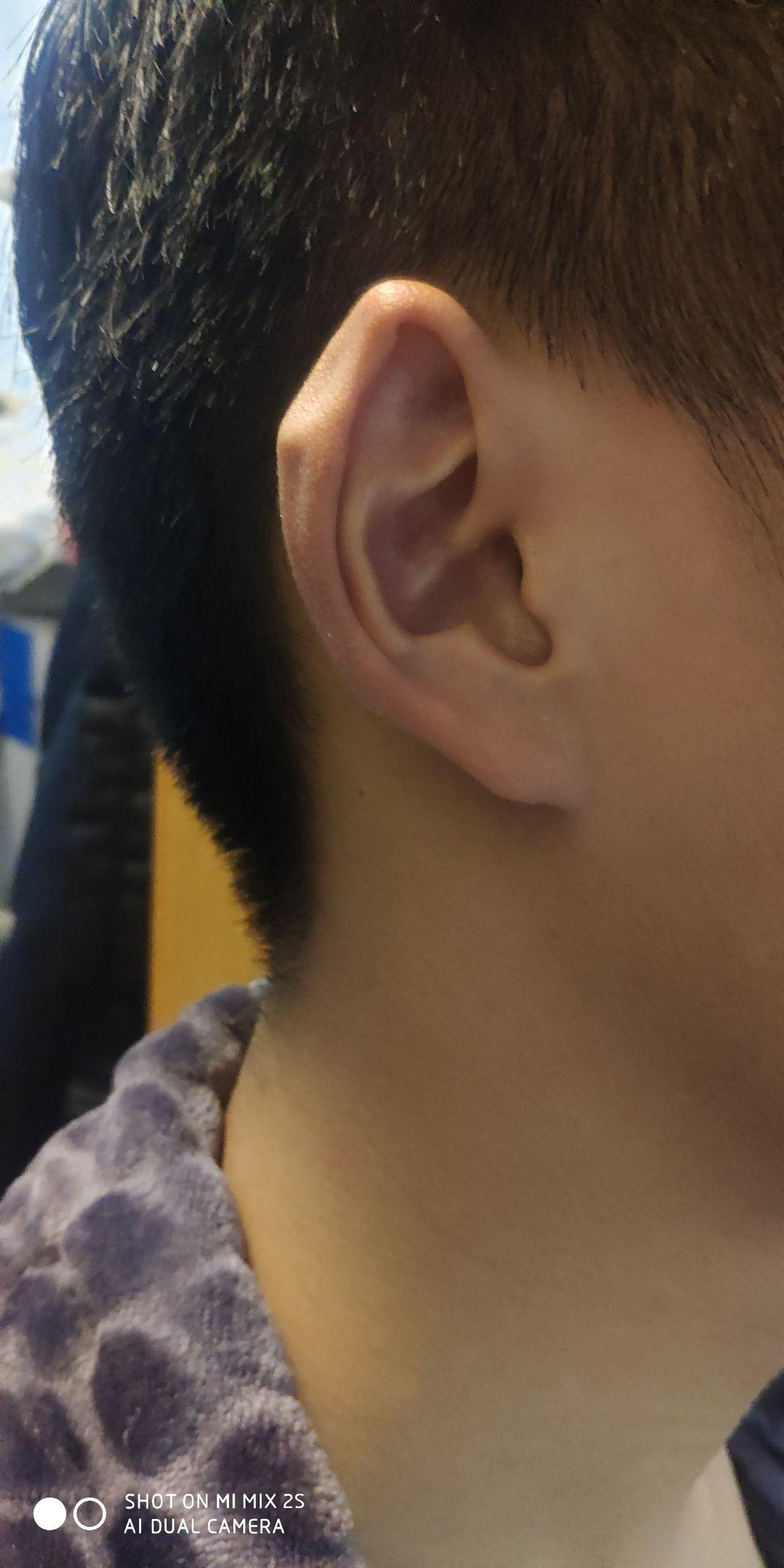 大多数人的耳朵上端是圆的,为什么有极少人的耳朵上端是尖的像兔子耳