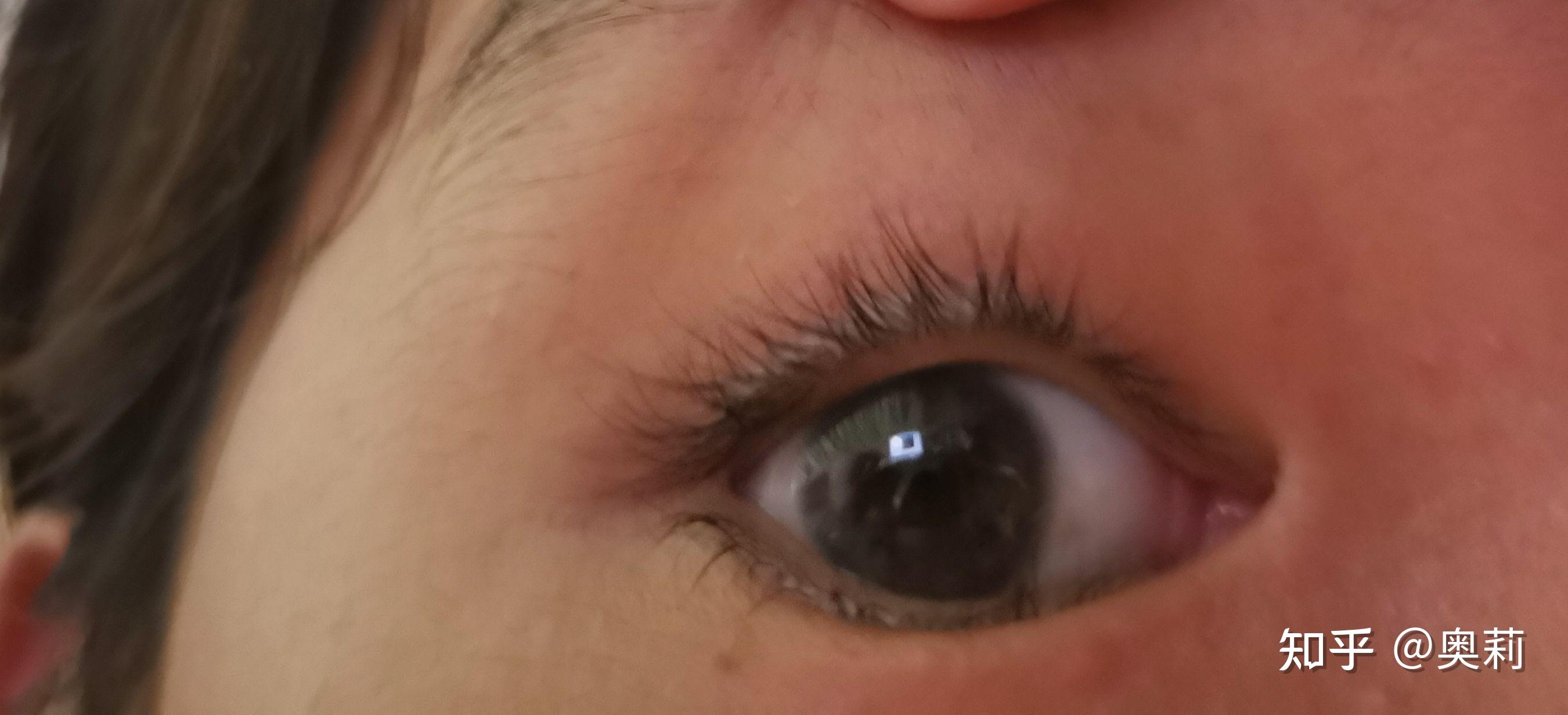 双睫症到底是啥?