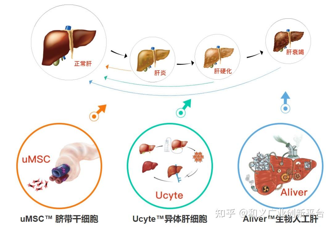 mars人工肝示意图图片