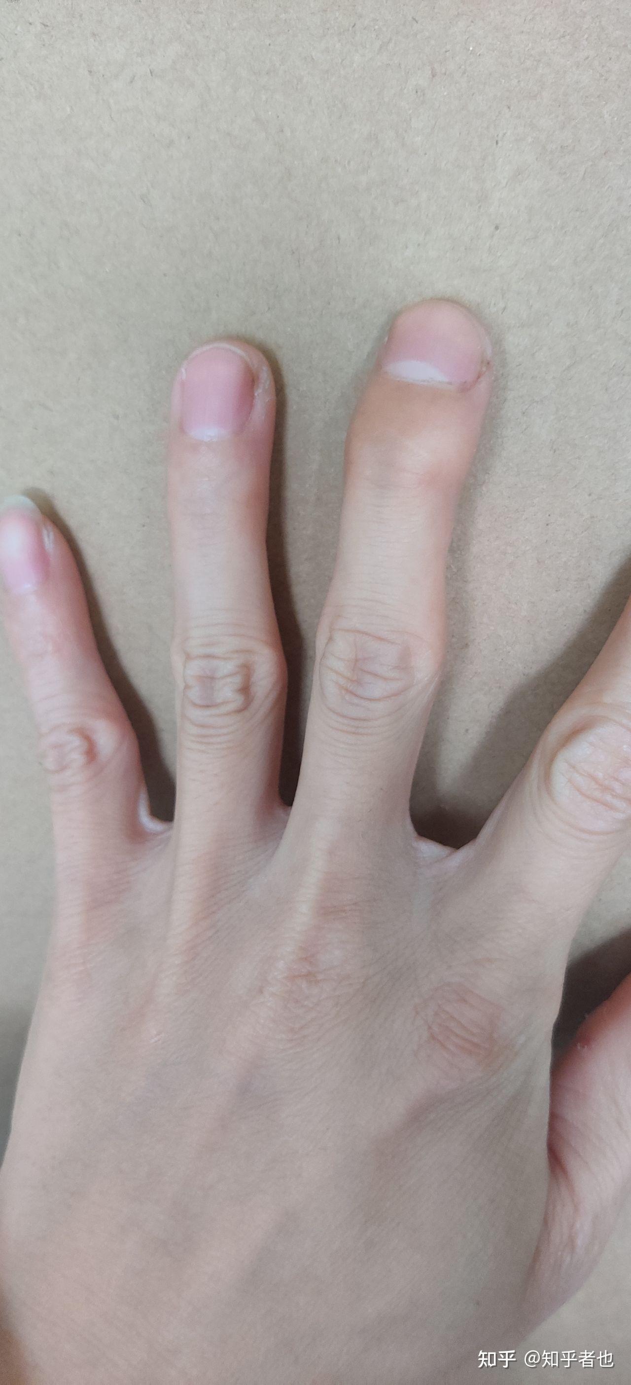 你有哪位朋友知道我这是什么病?