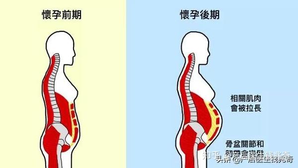 腰痛下腹部痛妊娠