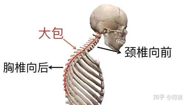 富贵包的 危害 知乎