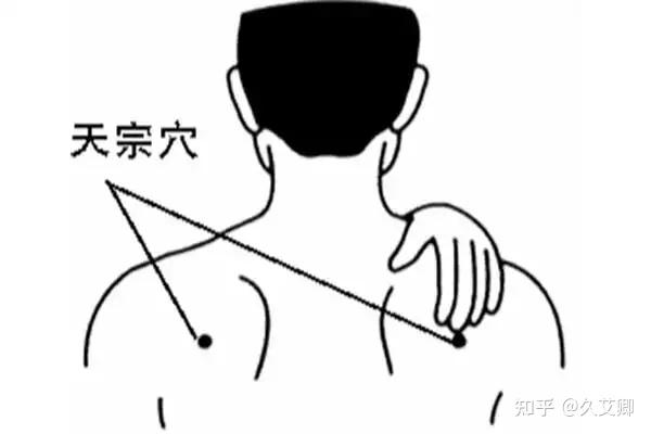 艾灸如何治疗风寒感冒,治疗风寒感冒的常见穴位? - 知乎