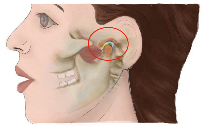 网友谈颞下颌关节紊乱丨什么是颞下颌关节紊乱病?