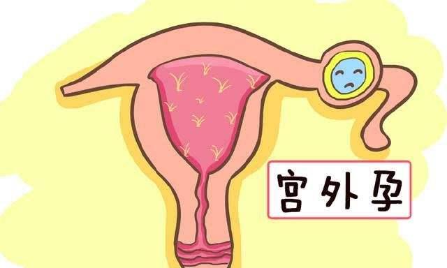 不幸宫外孕,多久可以再怀孕?插图 不幸宫外孕后,多久可以再怀孕?