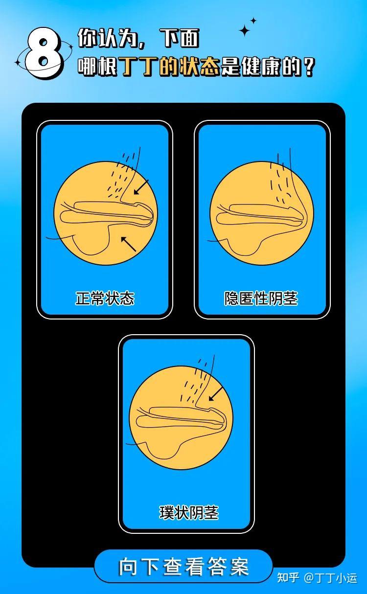 8张图详解一根好丁的8大外形指标大小硬度角度