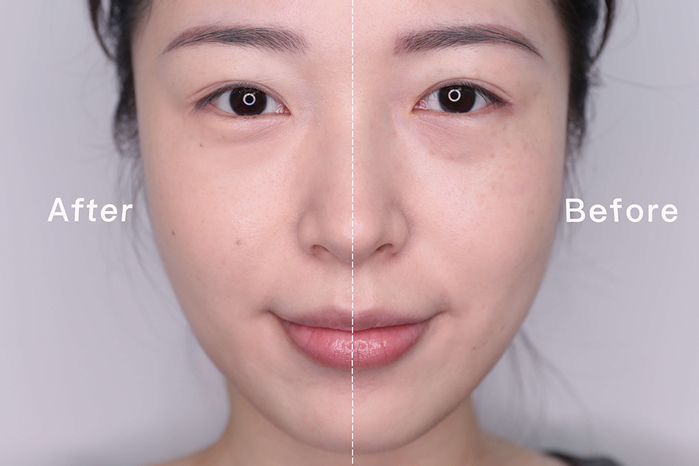 新手也能学会的整容级遮瑕术 - 知乎