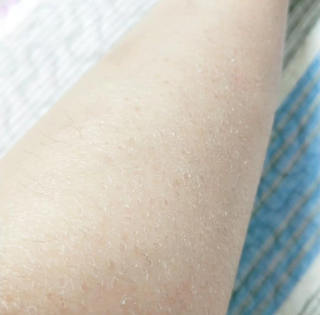 用刮刀刮完腋毛可以用身体乳吗(用刮刀刮完腋毛可以用身体乳吗女) 用刮刀刮完腋毛可以用身体乳吗(用刮刀刮完腋毛可以用身体乳吗女)