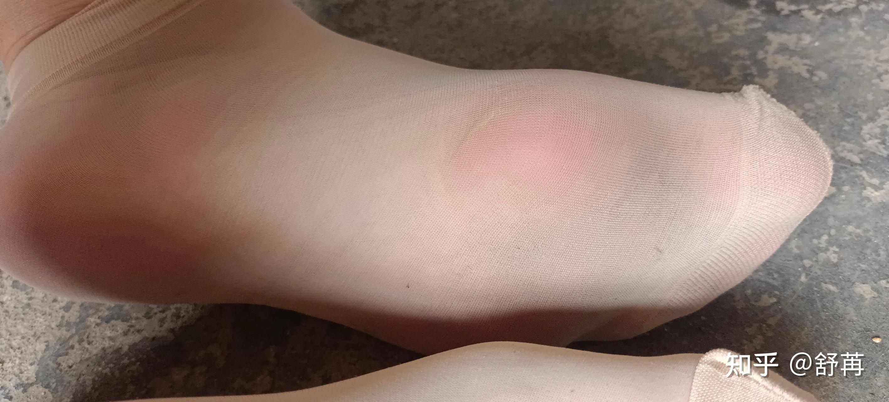 脚底长茧子穿超薄丝袜的脚底是怎么样的呢? - 知乎