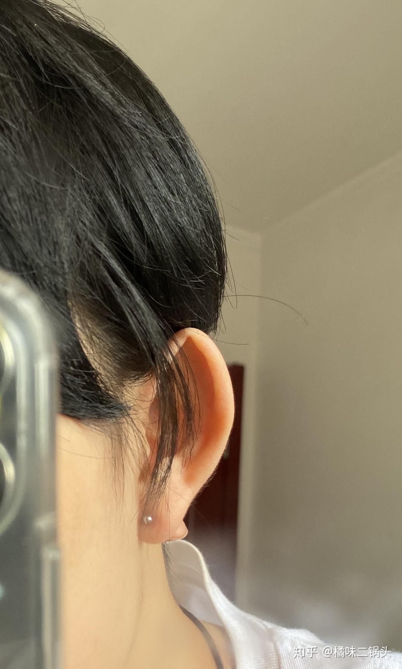 耳朵上端是尖的像精灵一样,是反古现象吗? - 知乎