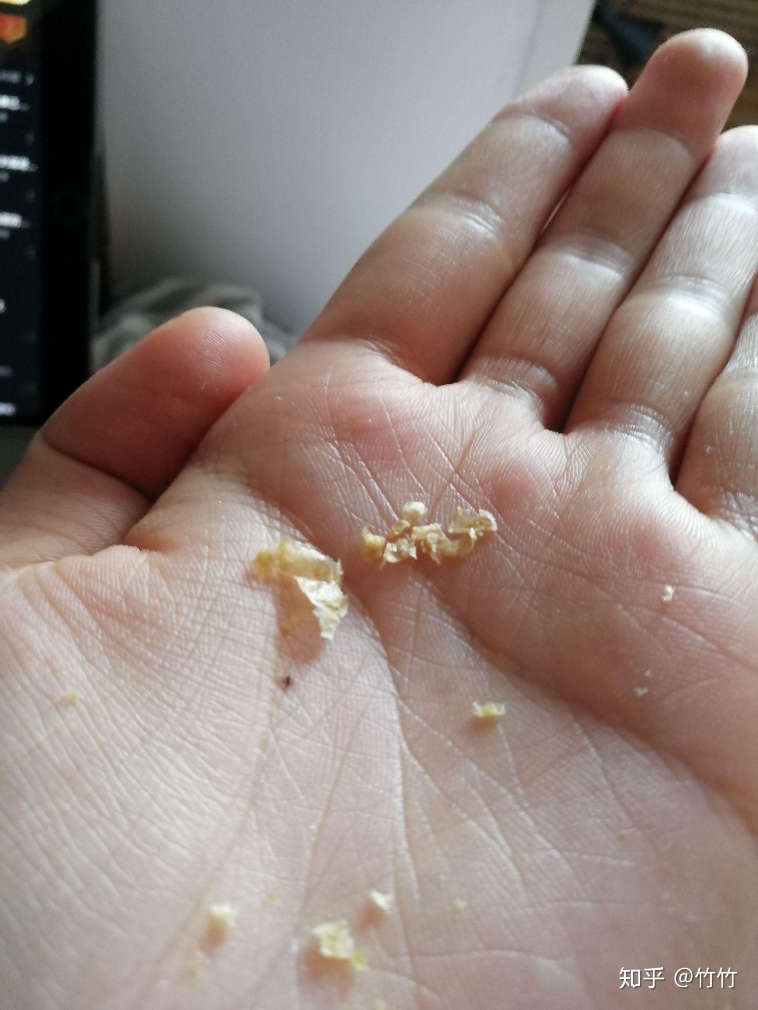耳屎能大到什么程度