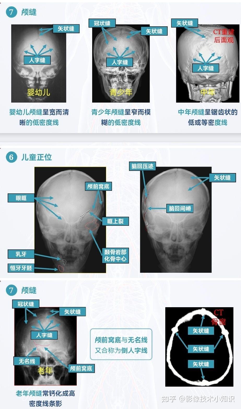 头颅X线摄影及其解剖 - 知乎