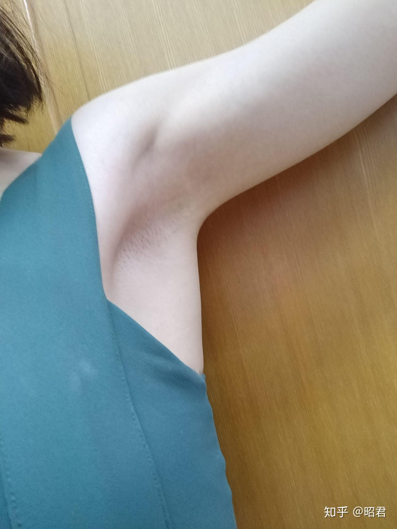 如何在暑假期间变美? - 知乎