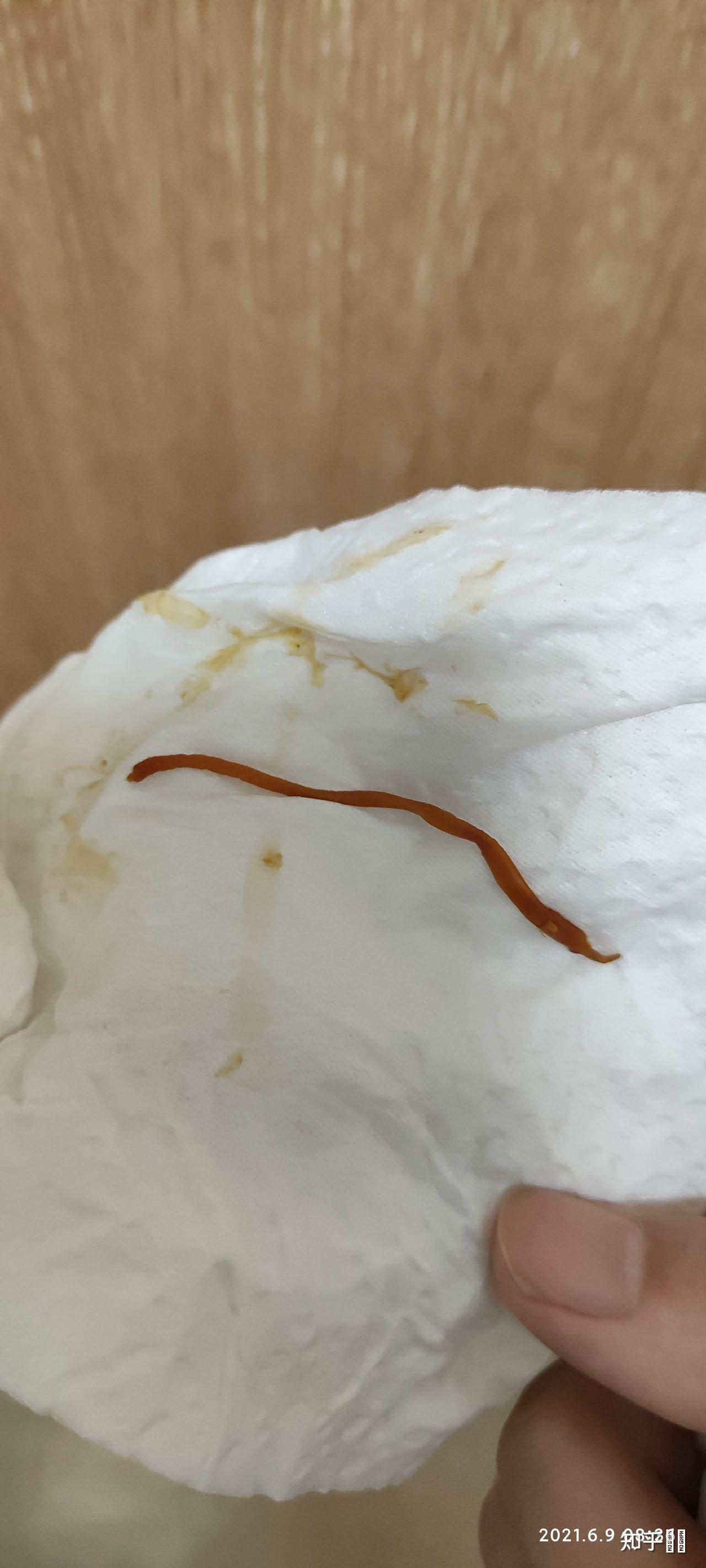 今天上厕所拉了好大一条蛔虫出来怎么办
