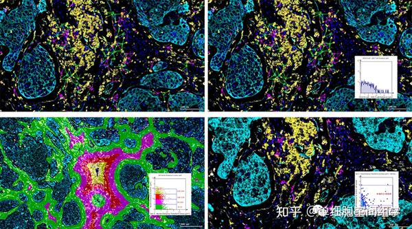 Hepatology|中山大学附属第一医院匡铭教授团队揭示肝细胞癌射频消融后复发潜在机制 - 知乎