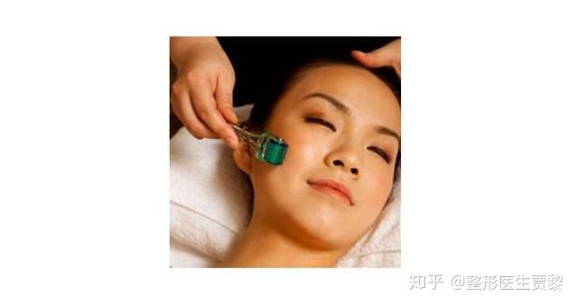 打什么针可以去闭口 v2-249bf94042d1450c191c7f389b11971f_r.jpg