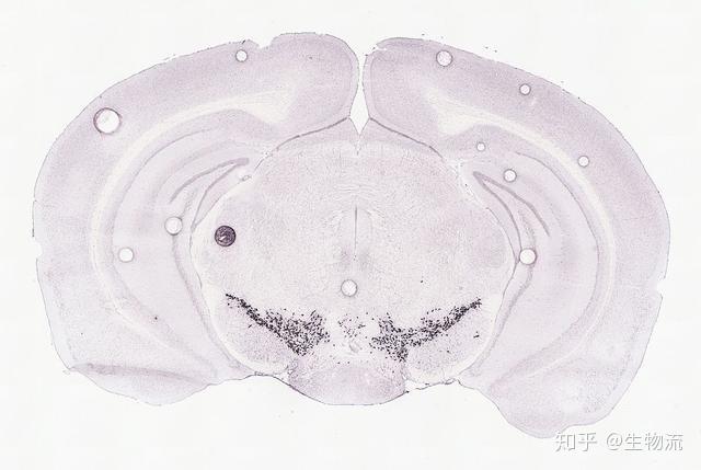 小鼠脑图谱黑质图片