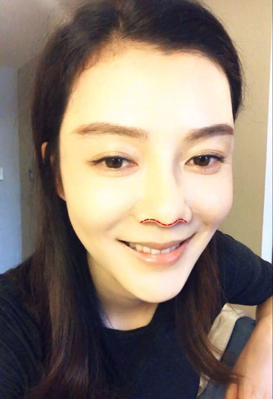海鸥线决定了你的鼻子美不美?