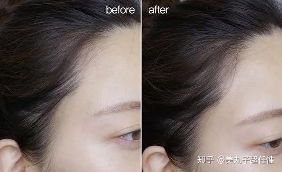 怎样的发际线才算高,我这样的发际线算不算高? - 知乎