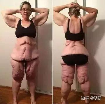 怎么样减肥不反弹瘦的快一些 v2-24d336331d1c8cc057af2c76b2ac3808_b.jpg