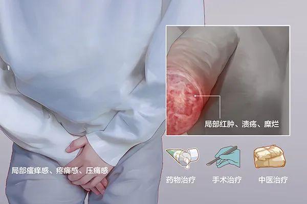 男性龟头有异味正常的吗