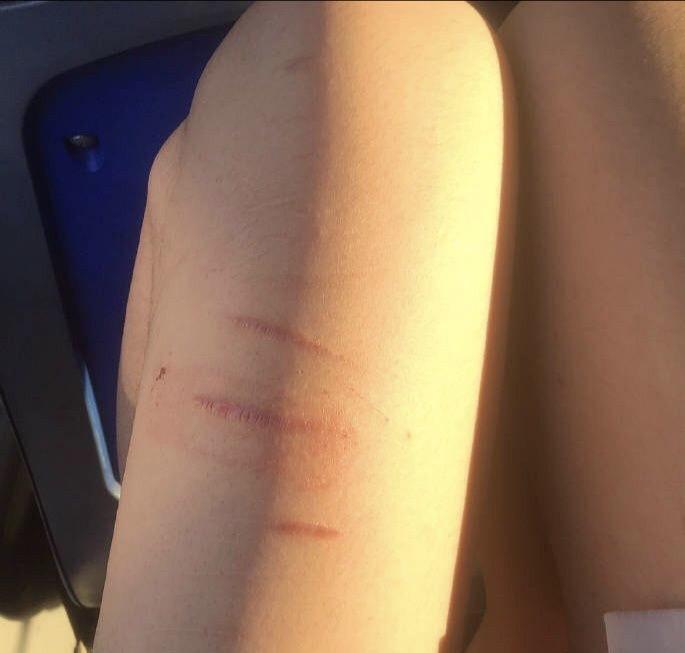 怎么遮自残的伤疤