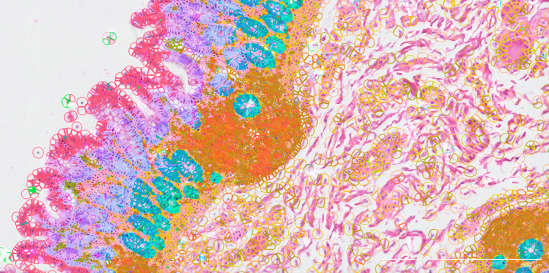 什么，你还没用上Xenium？快来看看最近大热的【Xenium空间原位分析】 - 知乎