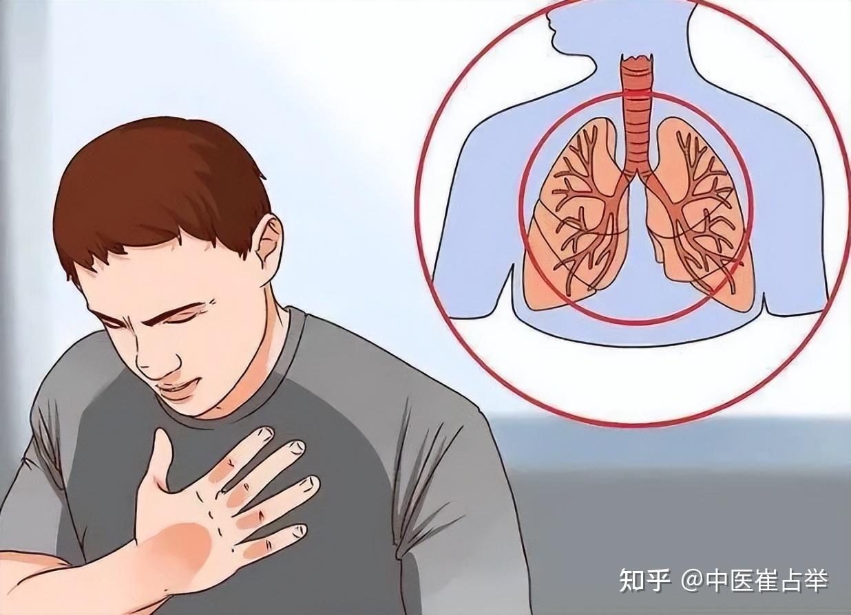 痰多吐不完?初痰在肺、湿痰在脾,老痰在肾!一举把痰“挖”干净 - 知乎