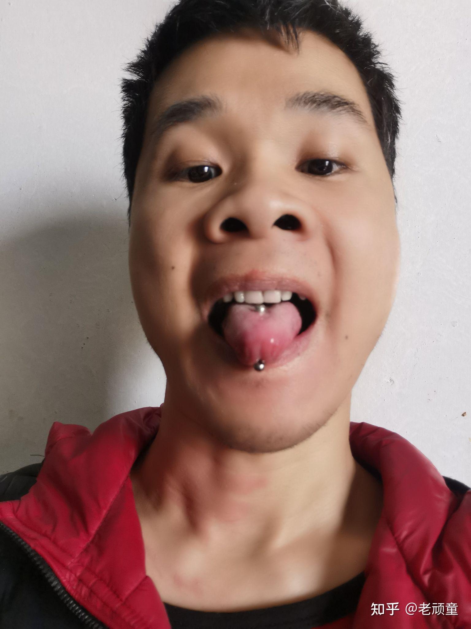 打舌钉多久换舌钉? - 知乎