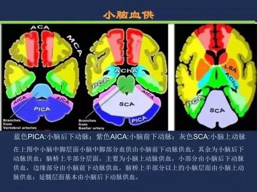 小脑中脚层面小脑中脚部分血供由小脑前下动脉供血