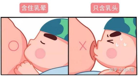 原来,小c的先天哺乳条件不好:乳头短小,其中一侧乳房的乳头扁平,导致
