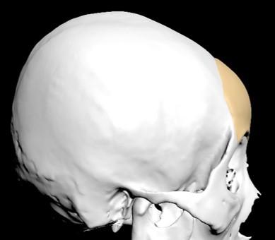 3d定製人工骨在頜面整形的應用