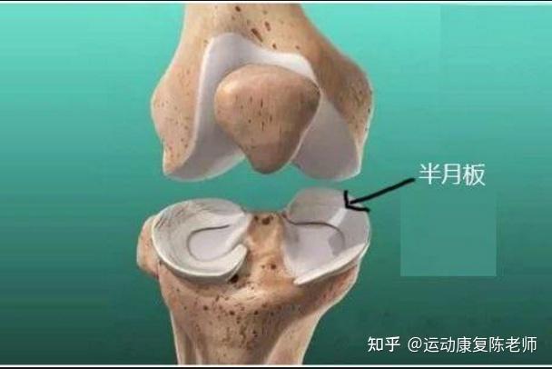 半月板损伤后还能正常生活工作吗