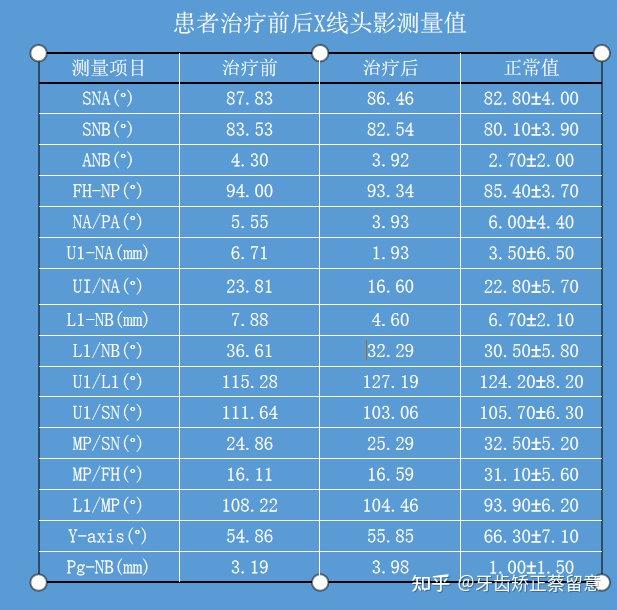 鄭州牙齒矯正個性化舌側矯正骨性疑難正畸病例的優選解決的方式