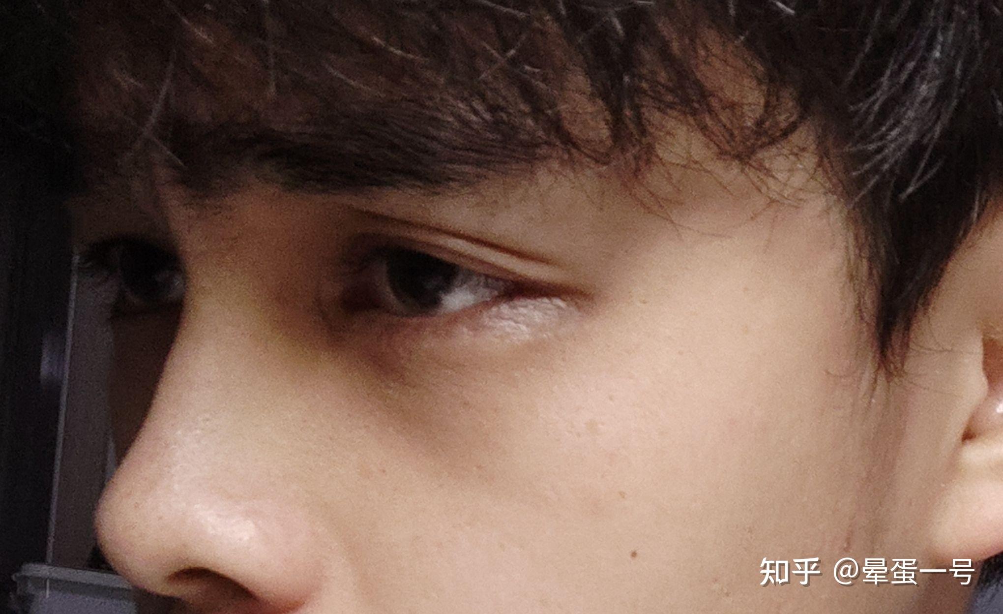 什么样的鼻子才算是高鼻梁，有什么标准？ - 知乎