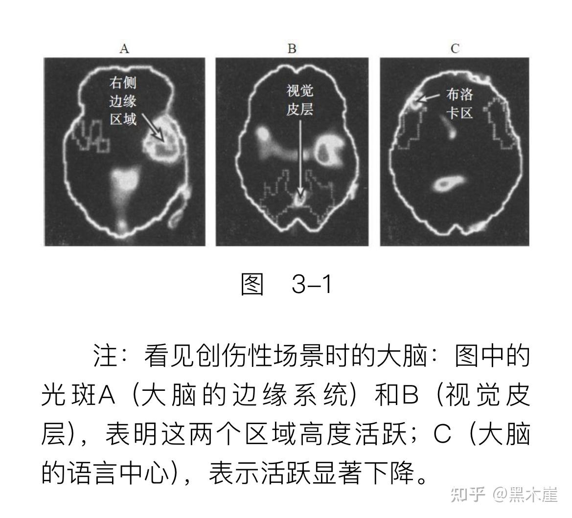美）巴塞尔·范德考克《身体从未忘记》摘录（上）：心理创伤疗愈