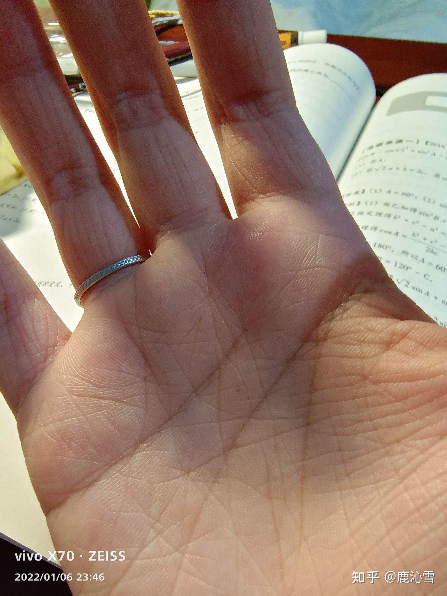 合和痣这个美丽的传说可以信吗? - 知乎