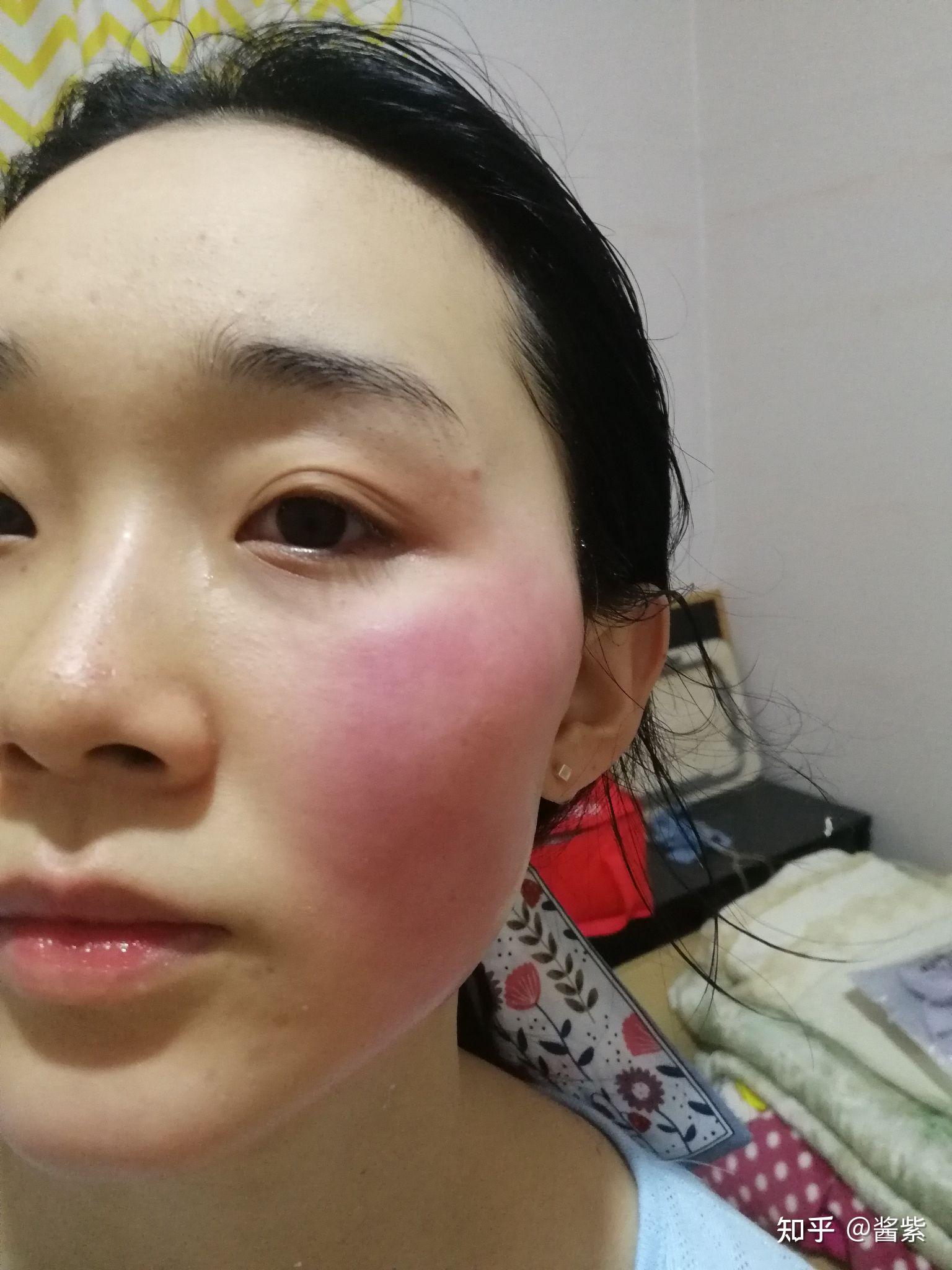 一热整张脸就特别红是怎么了? - 知乎