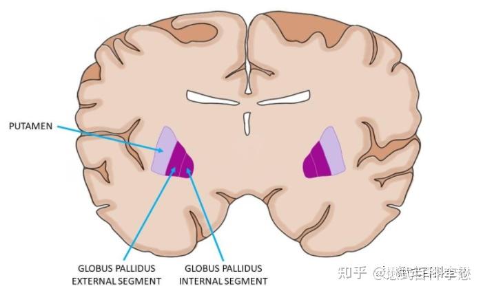 蒼白球(globus pallidus)位於顱腦基底核,其位置在殼核的內側,內囊的