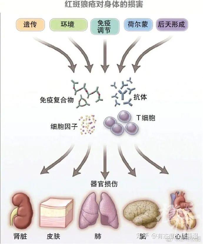 周海媚32歲患系統性紅斑狼瘡25年後的死亡率超50