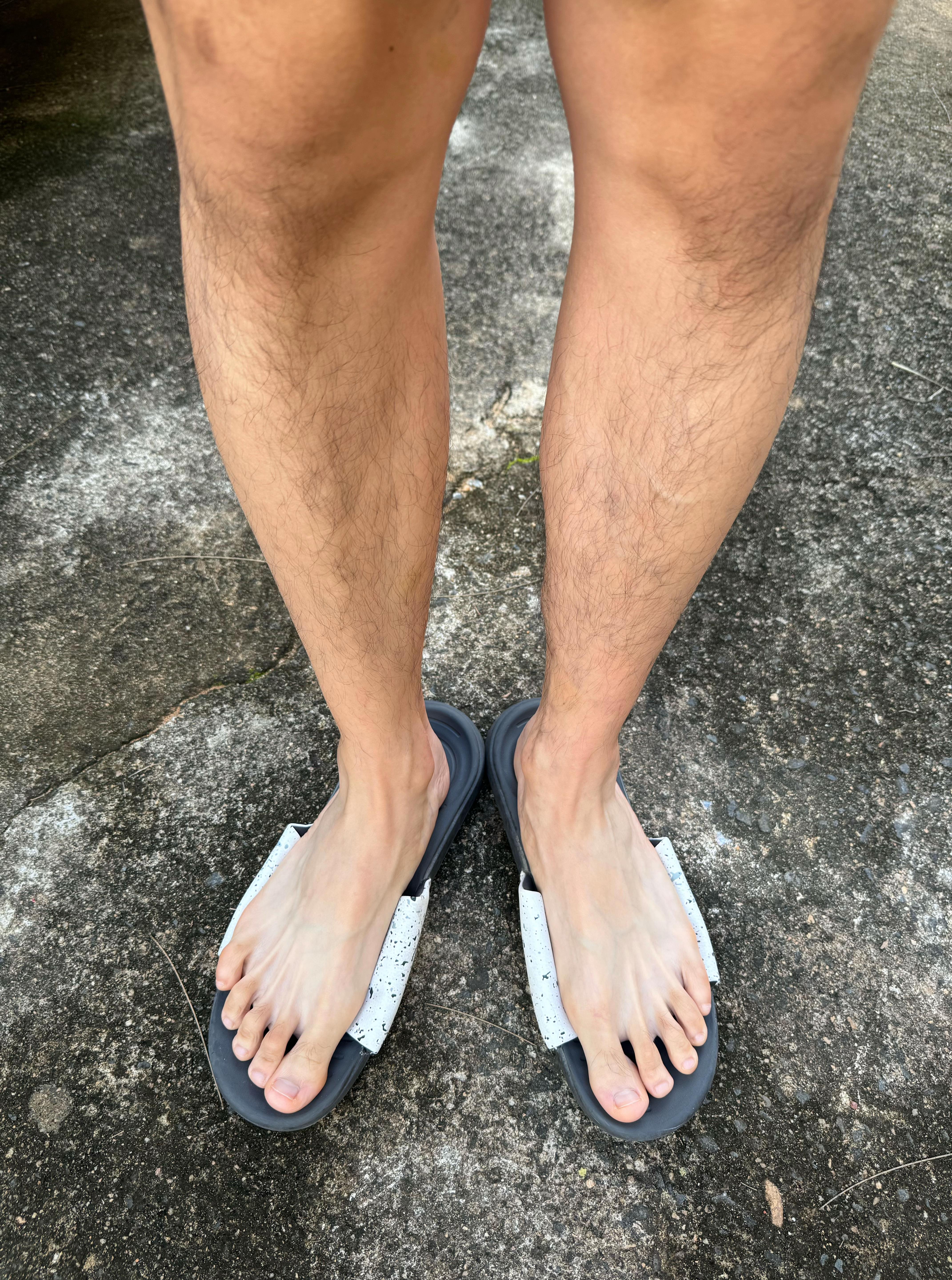 男生腿毛浓密怎么办?