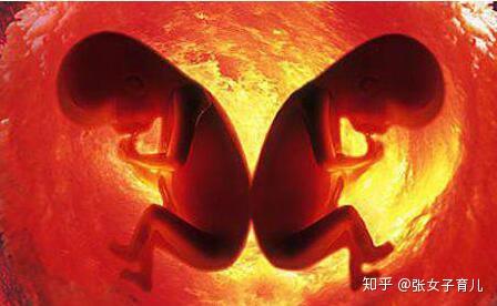 如果你怀孕了,身体这几种症状明显,说明怀双胞胎几率大 - 知乎