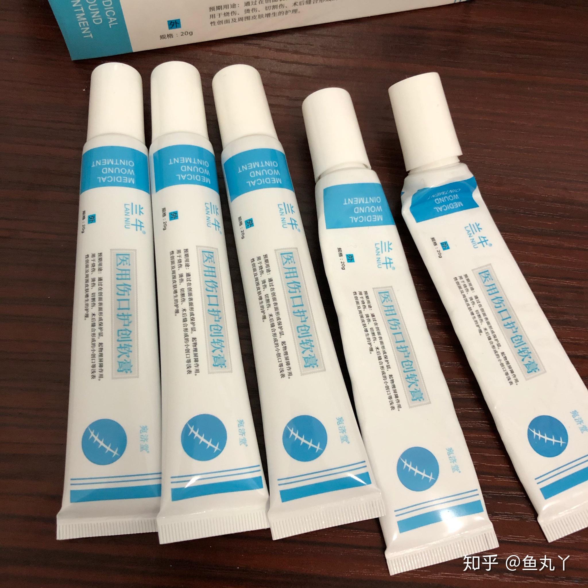 被刚煮沸的开水烫伤,浅二度烫伤的恢复过程!
