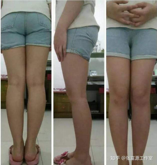 这么多种腿型你是哪一种呢